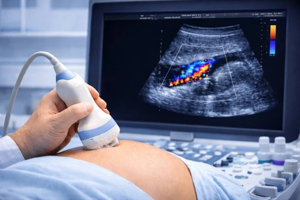 Ultrasound